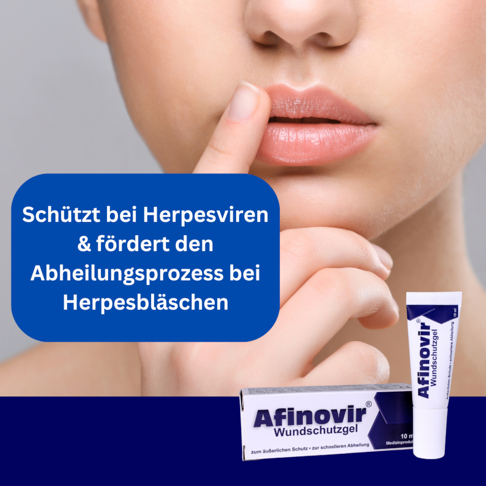 Afinovir Wundschutzgel 10 ml Gel