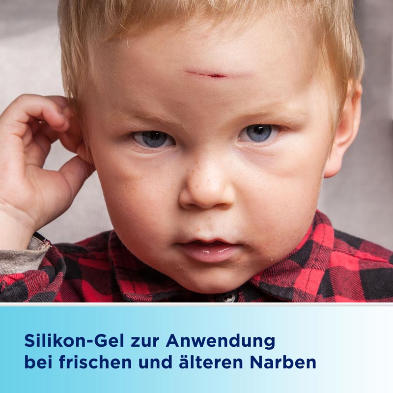 BepanCare Narben-Gel 20 ml Gel